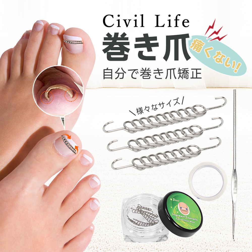 BS SPANGE 巻き爪 セット 巻き爪矯正、B/sスパンゲも試してみたけど・・・ | 巻き爪矯正を